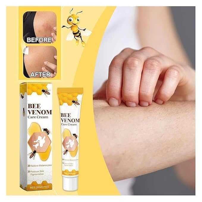 Bee Venom VitiGO Correcting Cream (Pack Of 2)